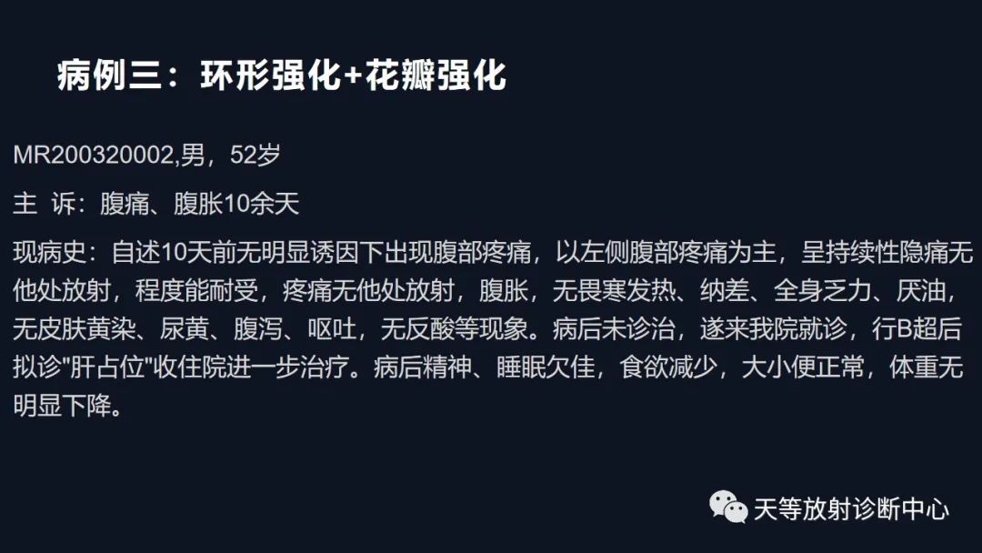 影像PPT - 【病例】肝脓肿1例CT影像-30 影像PPT - 【病例】肝脓肿1例CT影像-30