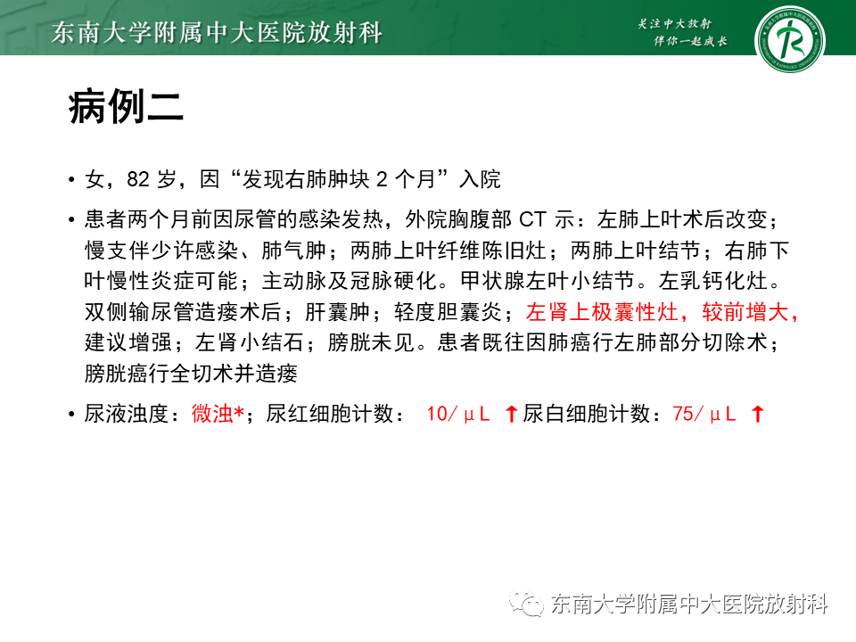 影像PPT - 【PPT】肾上腺占位病例随访-8