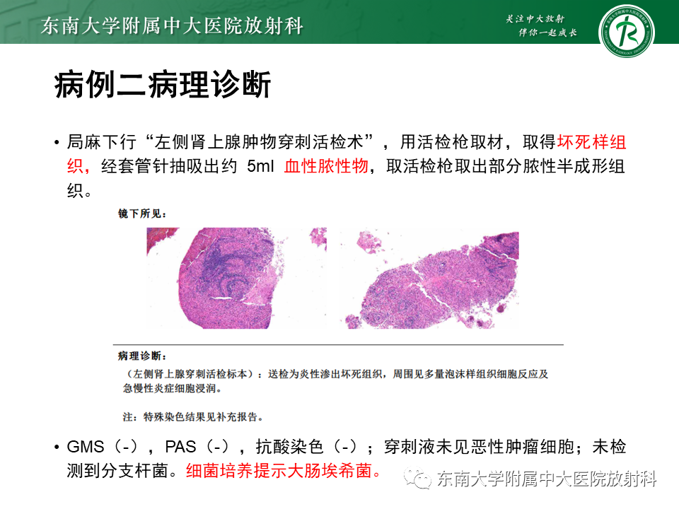 影像PPT - 【PPT】肾上腺占位病例随访-10