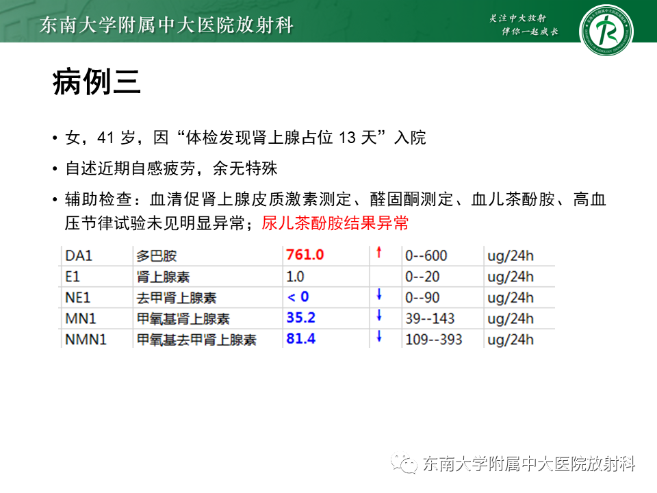 影像PPT - 【PPT】肾上腺占位病例随访-1