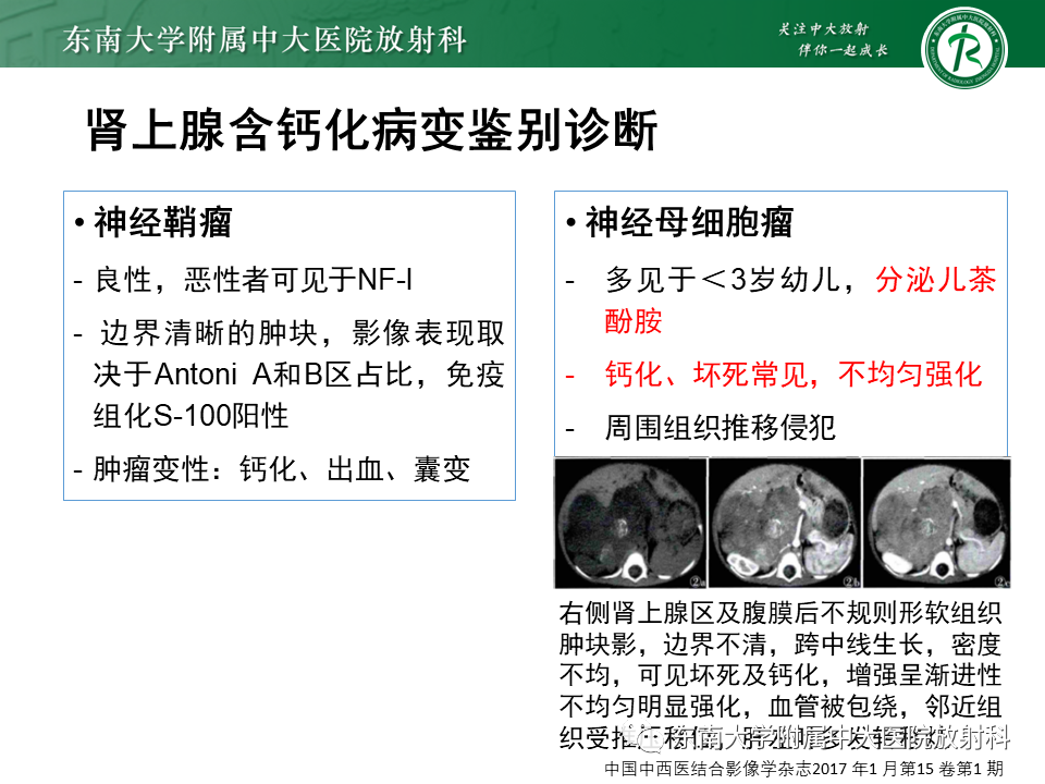 影像PPT - 【PPT】肾上腺占位病例随访-13