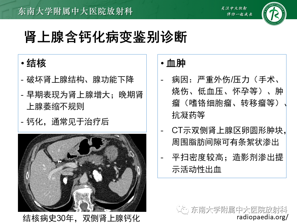 影像PPT - 【PPT】肾上腺占位病例随访-15