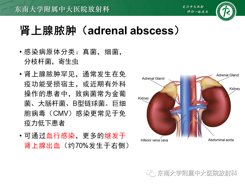 影像PPT - 【PPT】肾上腺占位病例随访-18