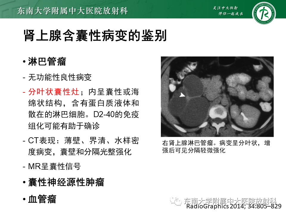 影像PPT - 【PPT】肾上腺占位病例随访-24