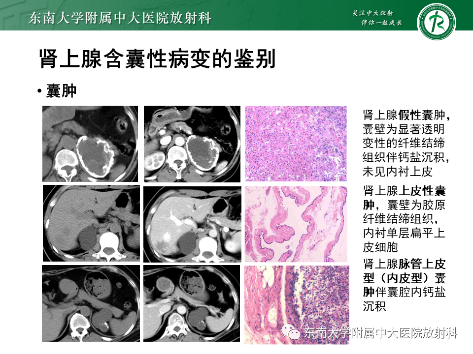影像PPT - 【PPT】肾上腺占位病例随访-23