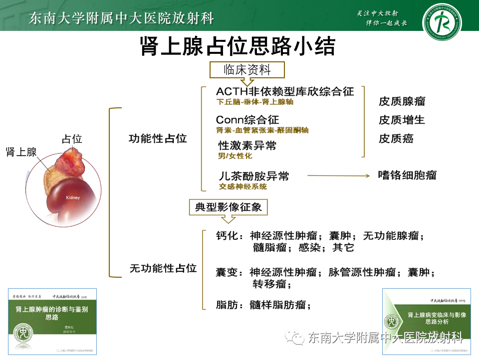 影像PPT - 【PPT】肾上腺占位病例随访-31