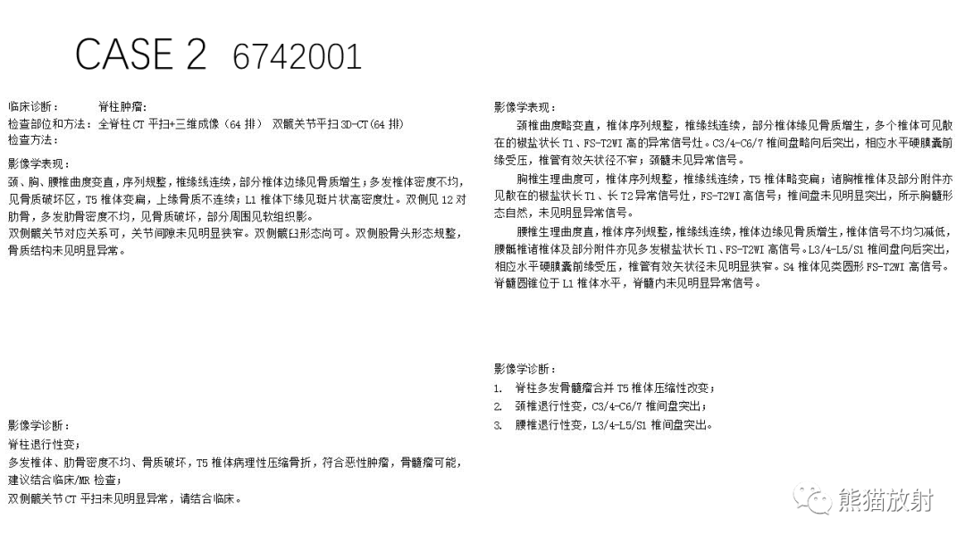 影像PPT - 【病例】多发性骨髓瘤2例CT及MR影像-14