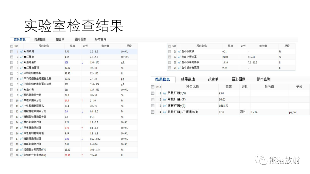 影像PPT - 【病例】多发性骨髓瘤2例CT及MR影像-2