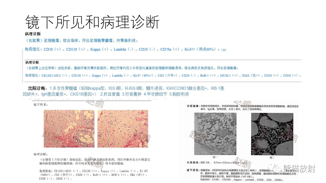 影像PPT - 【病例】多发性骨髓瘤2例CT及MR影像-6
