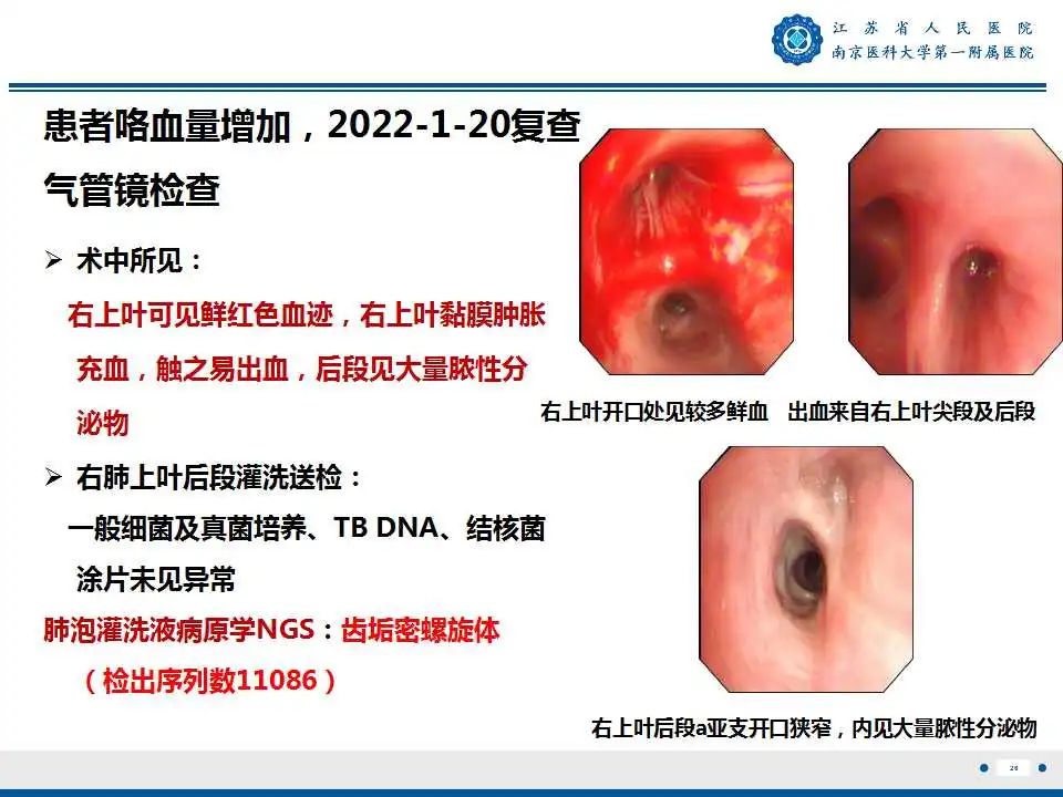 影像PPT - 【PPT】肺脓肿-26