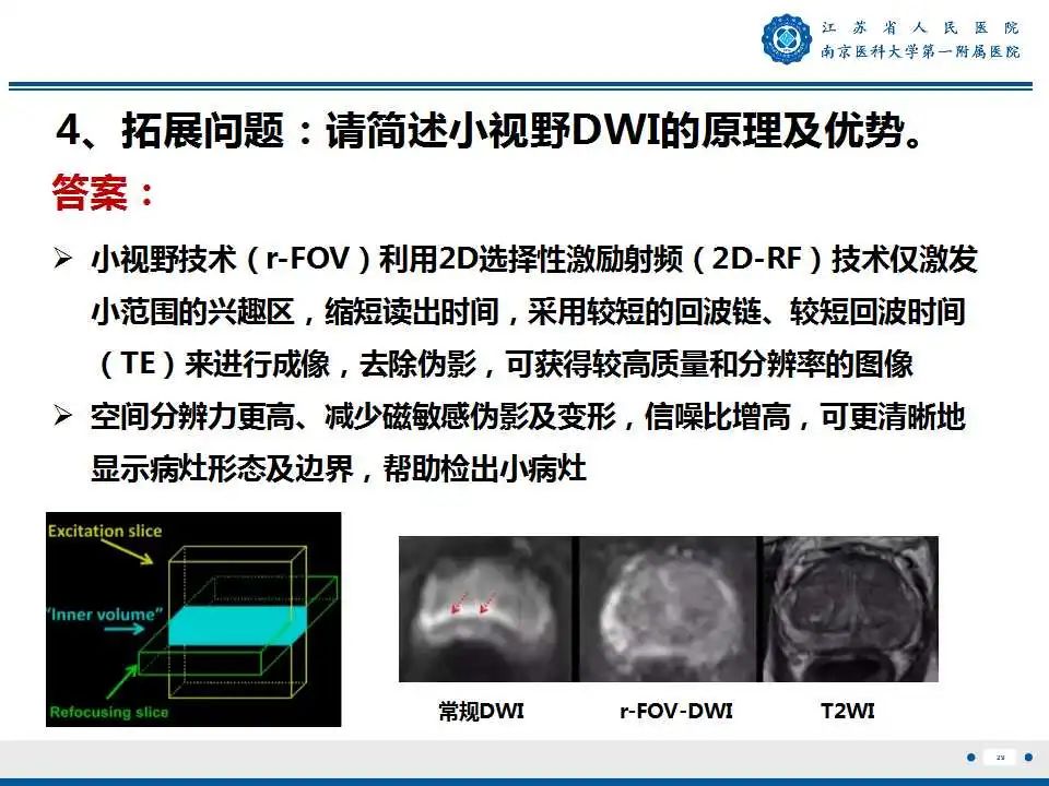 影像PPT - 【PPT】肺脓肿-29