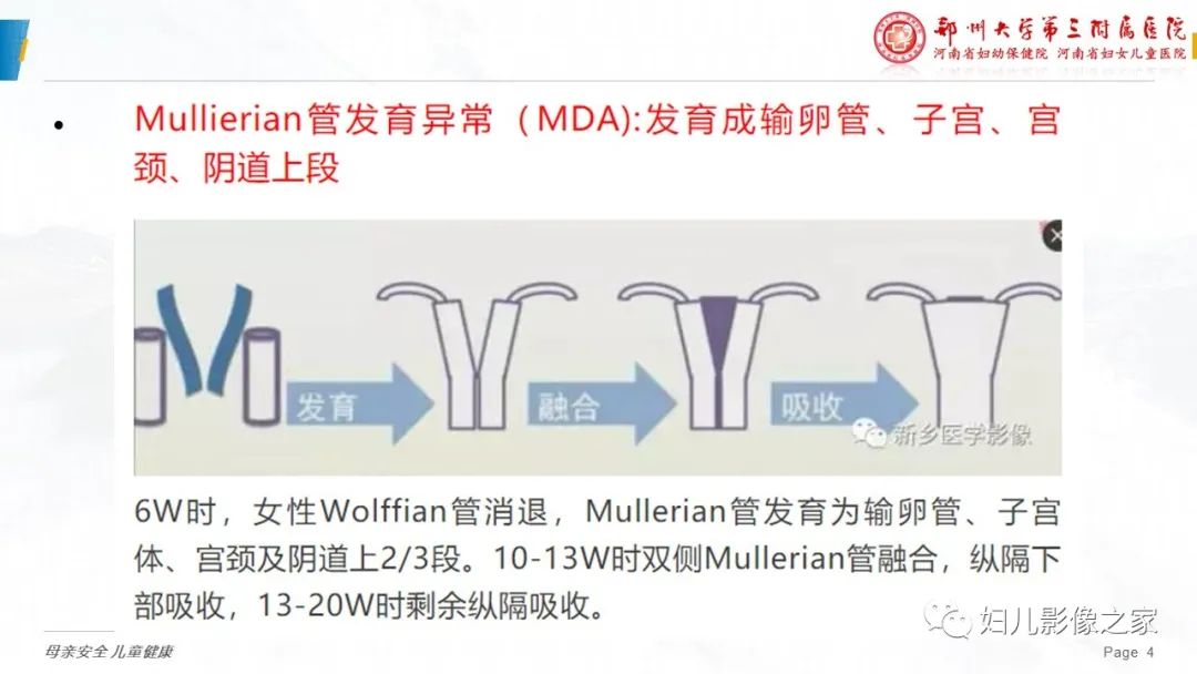 影像PPT - 【病例】先天性阴道闭锁1例MR影像-15