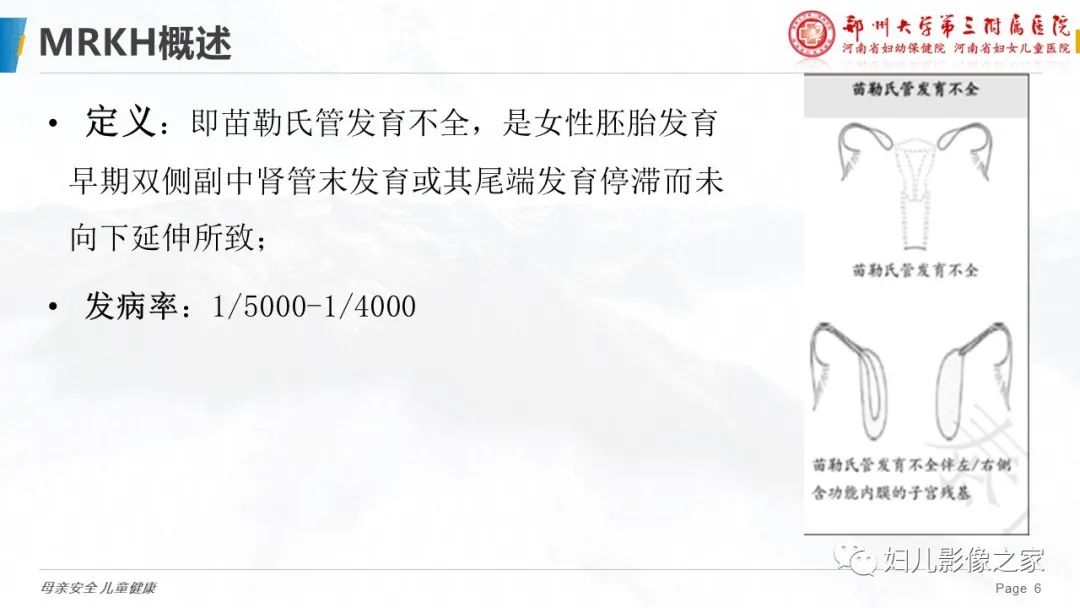 影像PPT - 【病例】先天性阴道闭锁1例MR影像-17