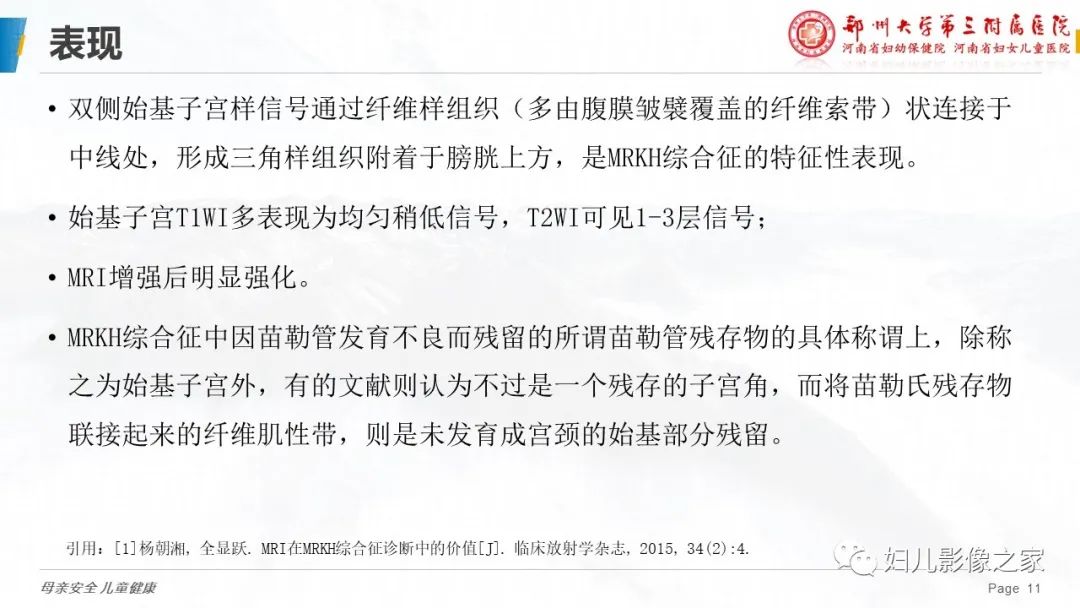 影像PPT - 【病例】先天性阴道闭锁1例MR影像-22