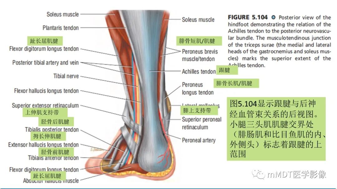 影像PPT - 【PPT】踝关节—跟腱损伤的影像分析-3 影像PPT - 【PPT】踝关节—跟腱损伤的影像分析-3