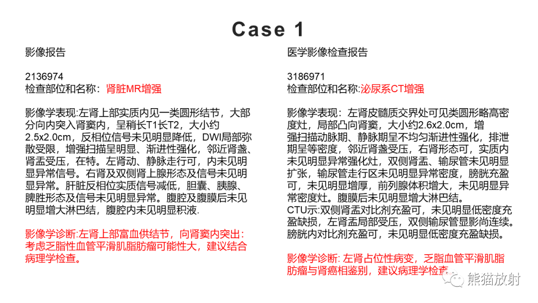 影像PPT - 【PPT】肾窦病变影像诊断思路-14