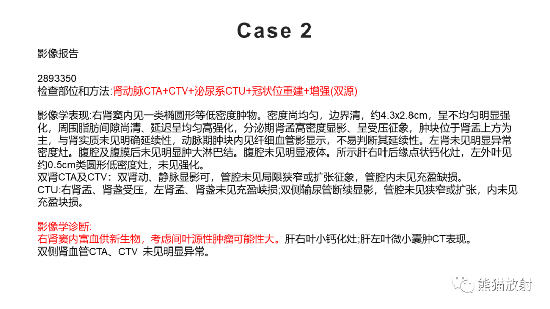 影像PPT - 【PPT】肾窦病变影像诊断思路-16