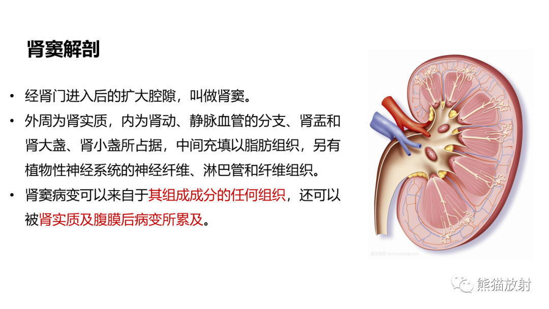 影像PPT - 【PPT】肾窦病变影像诊断思路-19