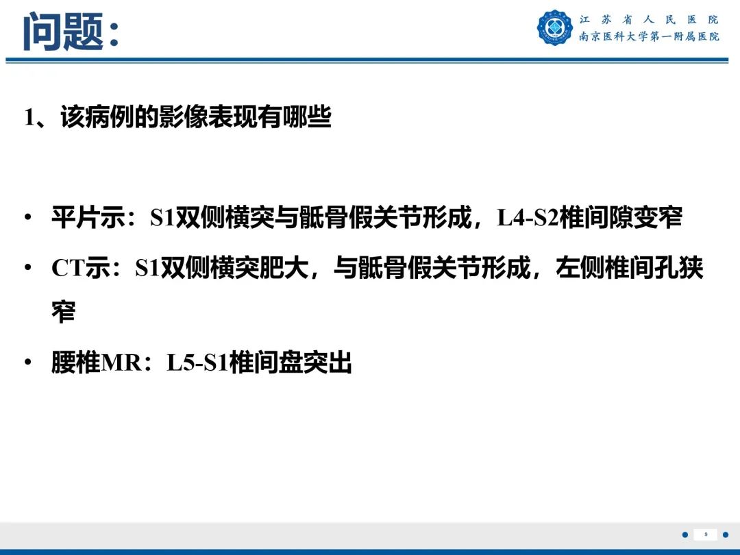 影像PPT - 【PPT】Bertolotti 综合征-10