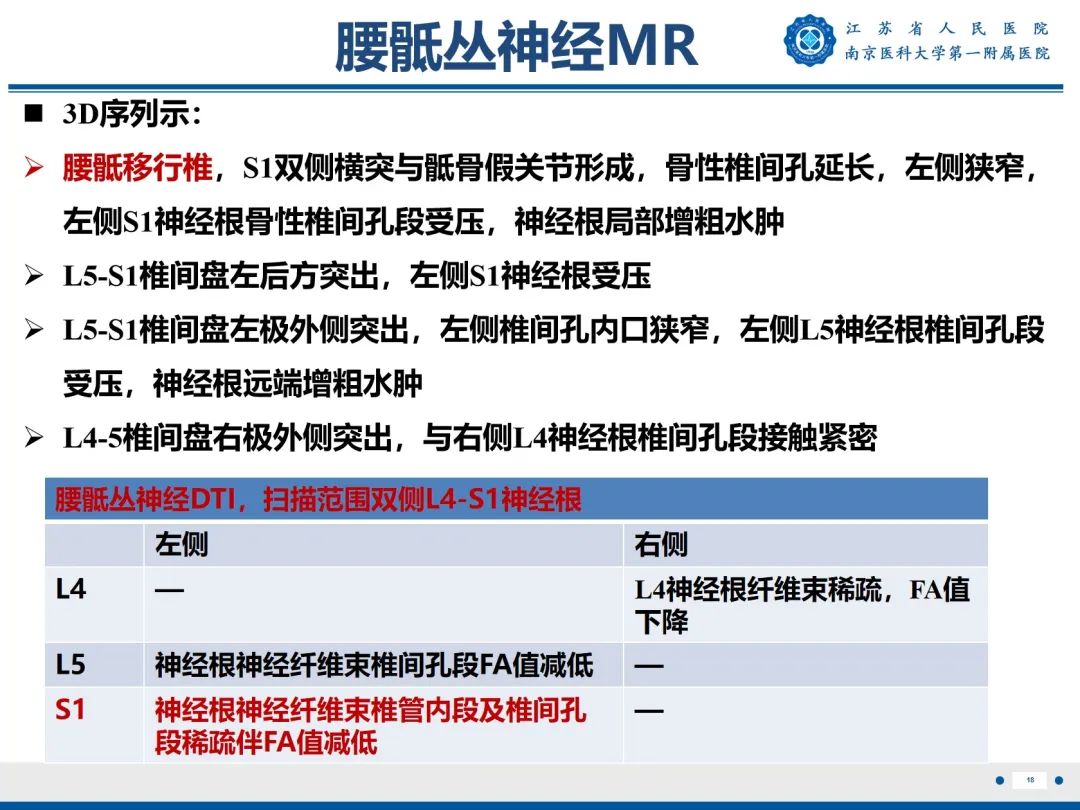 影像PPT - 【PPT】Bertolotti 综合征-19