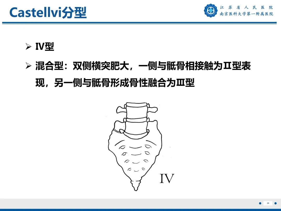 影像PPT - 【PPT】Bertolotti 综合征-25