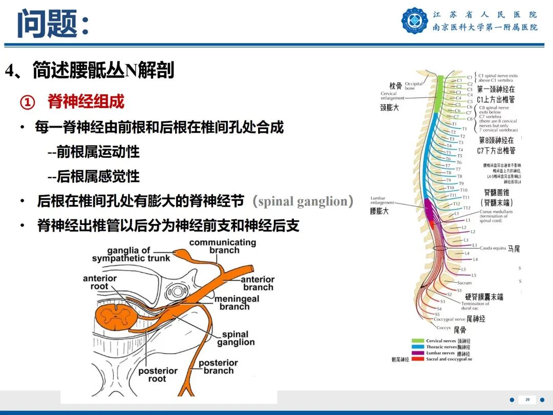 影像PPT - 【PPT】Bertolotti 综合征-30