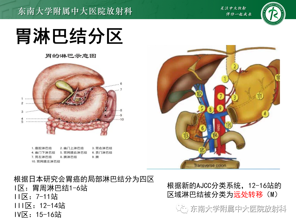 影像PPT - 【PPT】胃黏膜相关淋巴组织(MALT)淋巴瘤-6 影像PPT - 【PPT】胃黏膜相关淋巴组织(MALT)淋巴瘤-6