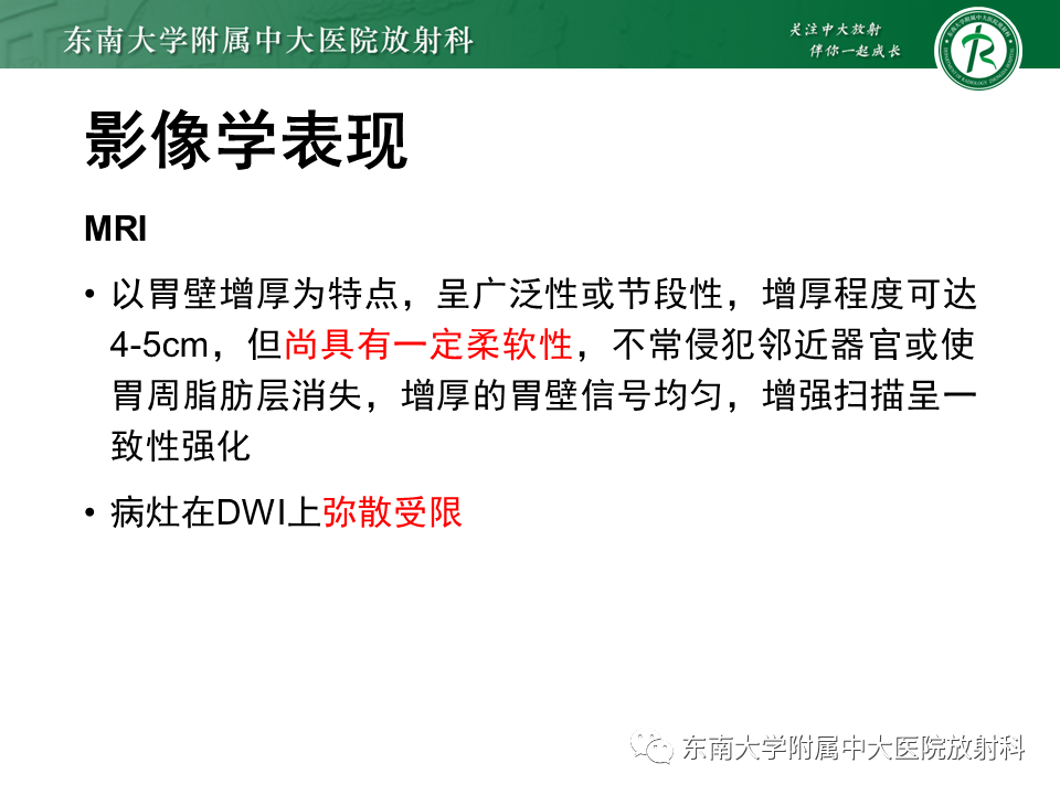 影像PPT - 【PPT】胃黏膜相关淋巴组织(MALT)淋巴瘤-16 影像PPT - 【PPT】胃黏膜相关淋巴组织(MALT)淋巴瘤-16