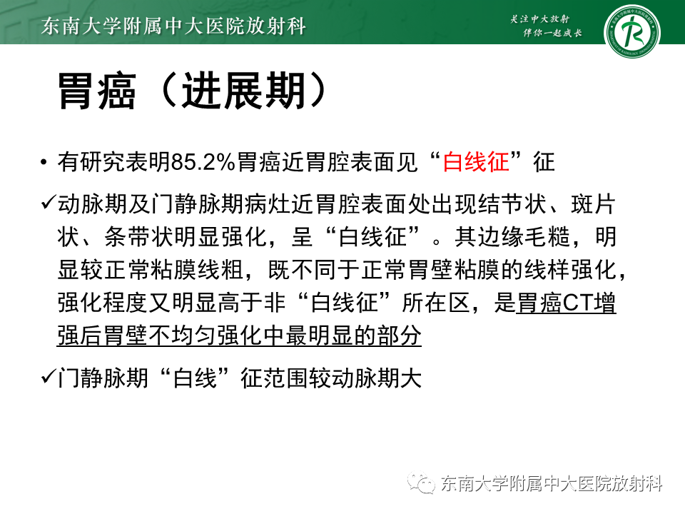 影像PPT - 【PPT】胃黏膜相关淋巴组织(MALT)淋巴瘤-29 影像PPT - 【PPT】胃黏膜相关淋巴组织(MALT)淋巴瘤-29