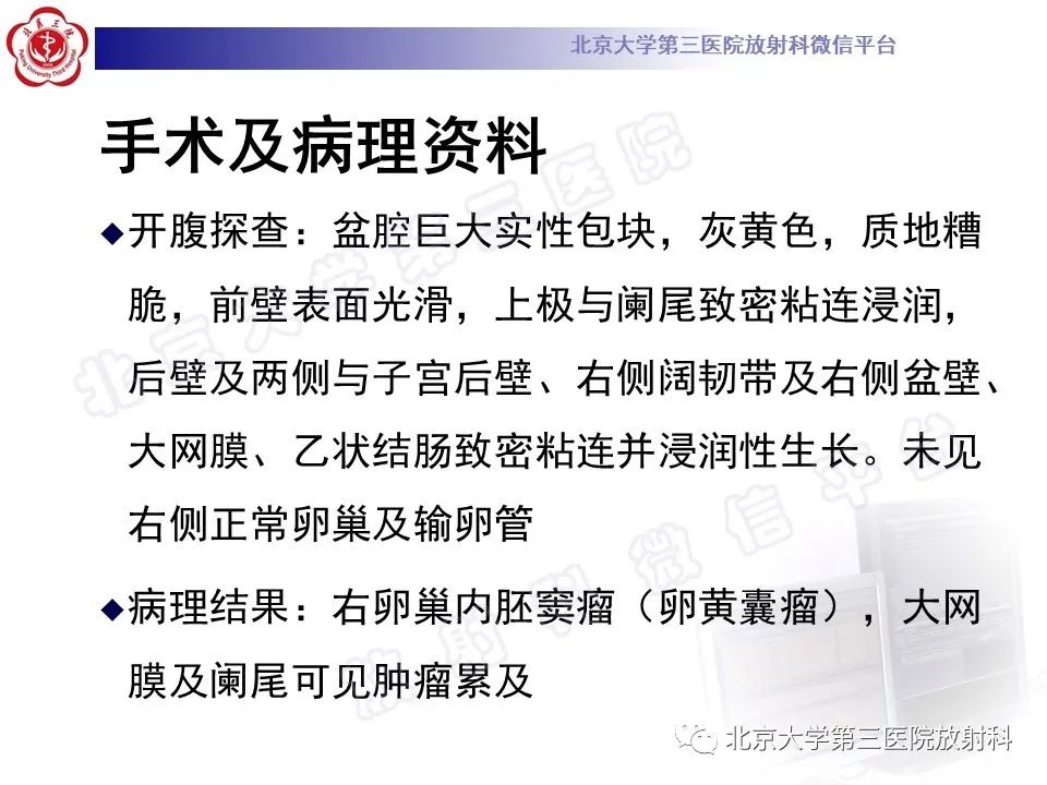 影像PPT - 【PPT】卵巢卵黄囊瘤/内胚窦瘤-8