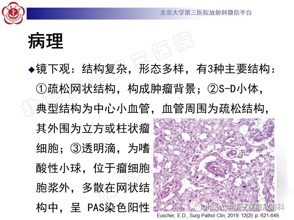 影像PPT - 【PPT】卵巢卵黄囊瘤/内胚窦瘤-12
