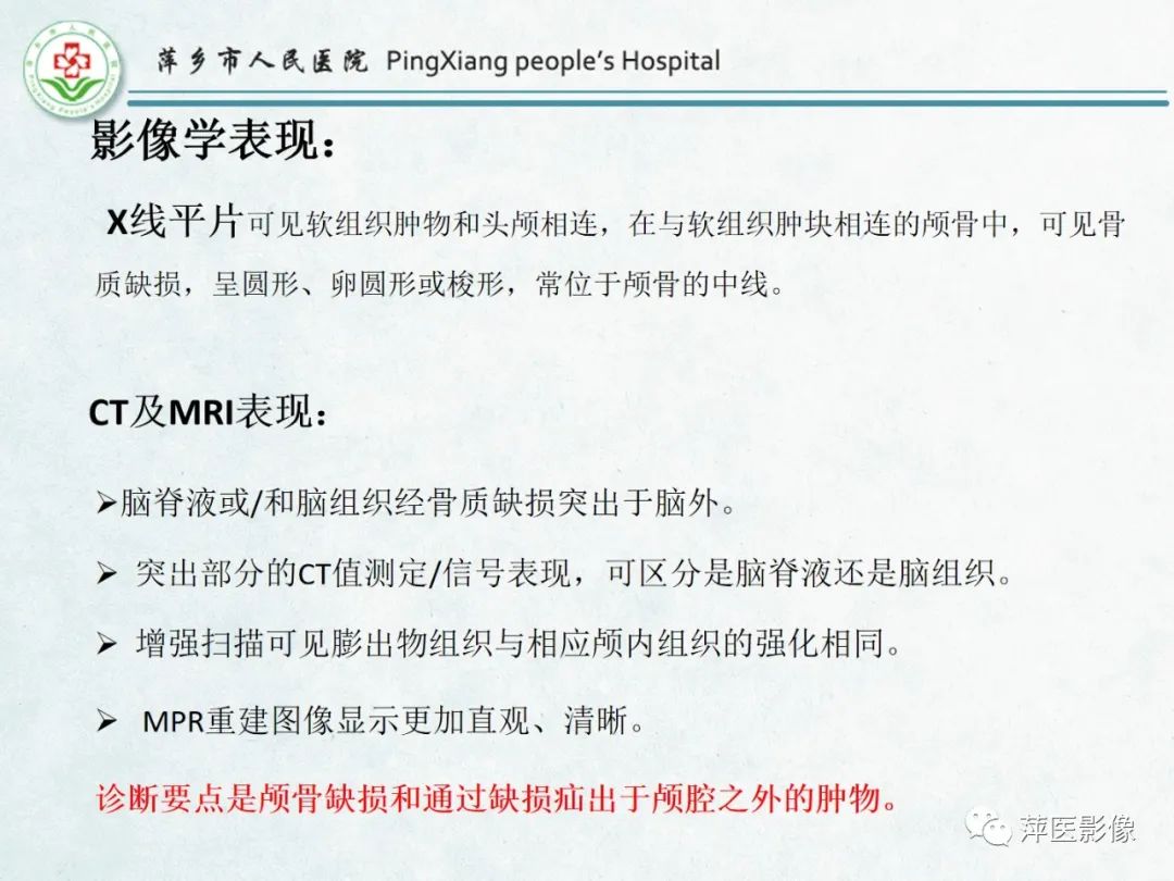 影像PPT - 【PPT】颅脑先天性畸形及发育异常的影像诊断-5