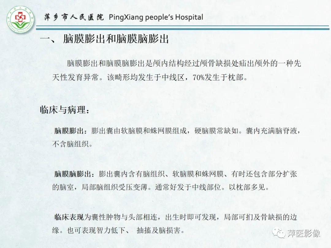 影像PPT - 【PPT】颅脑先天性畸形及发育异常的影像诊断-4