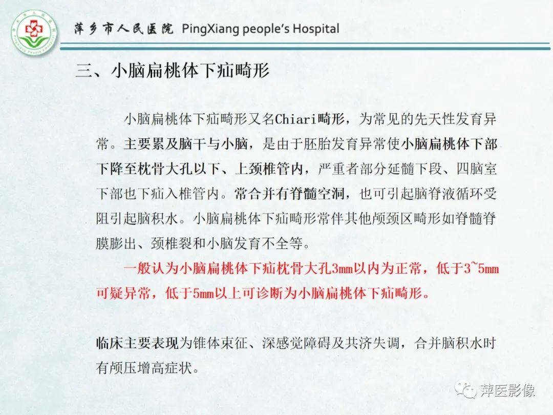 影像PPT - 【PPT】颅脑先天性畸形及发育异常的影像诊断-3
