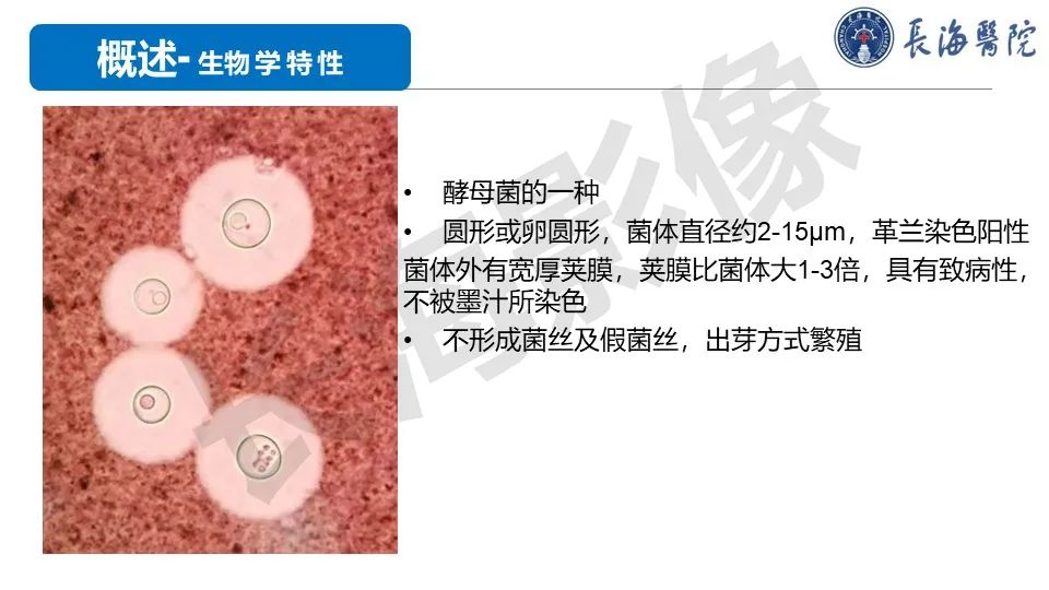 影像PPT - 【PPT】肺部隐球菌感染CT诊断-5