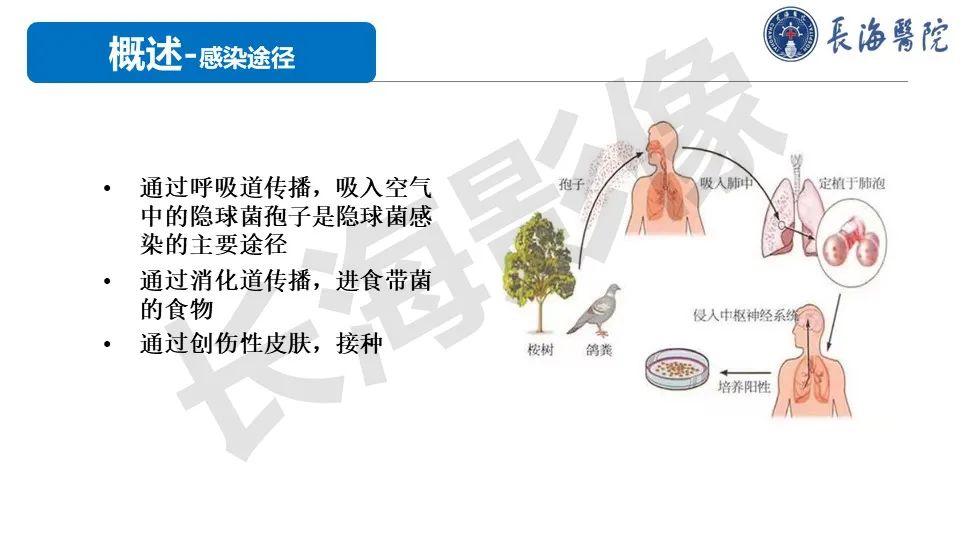 影像PPT - 【PPT】肺部隐球菌感染CT诊断-7