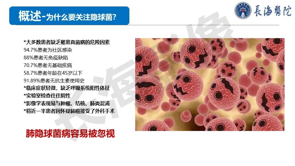 影像PPT - 【PPT】肺部隐球菌感染CT诊断-9