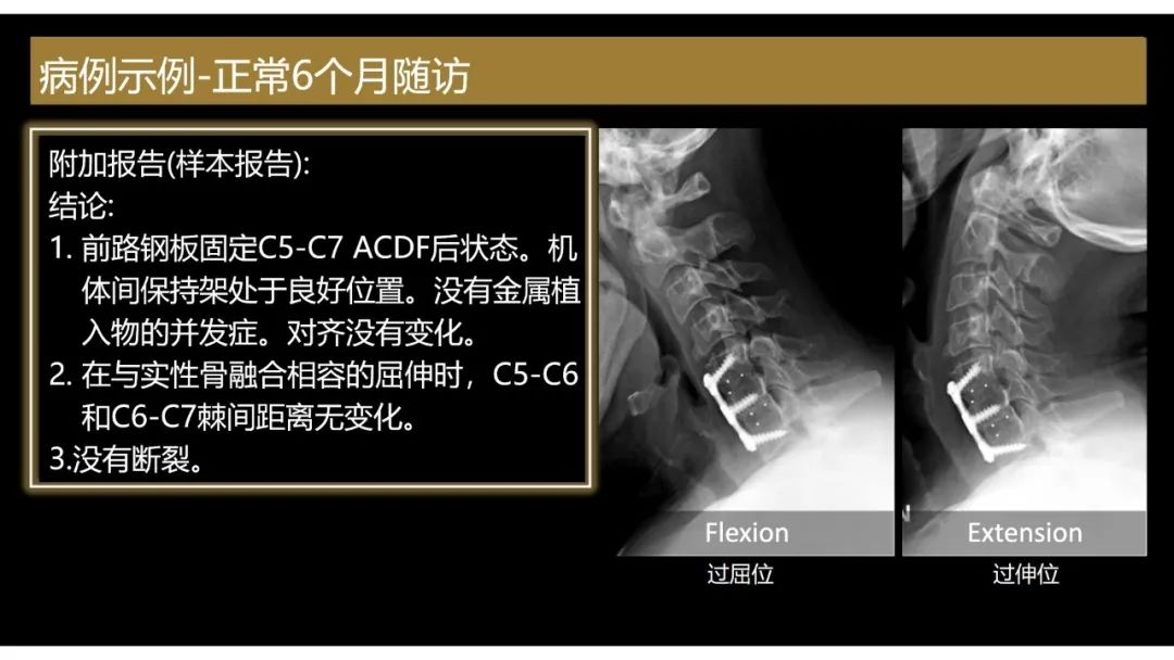 影像PPT - 【PPT】评估围手术期脊柱:除了退行性椎间盘疾病和金属植入物的并发症外-8