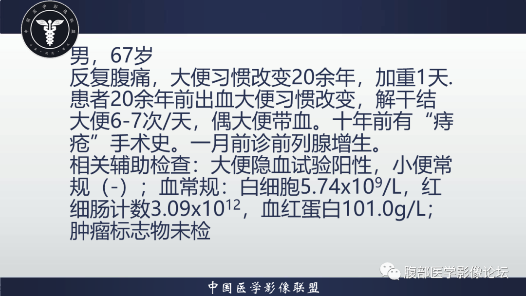 影像PPT - 【病例】直肠血管瘤1例CT及MR-2