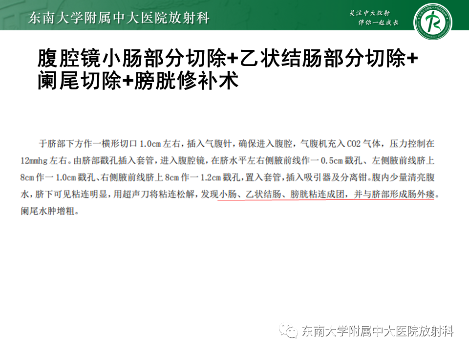 影像PPT - 【PPT】克罗恩(Crohn’s)病-9 影像PPT - 【PPT】克罗恩(Crohn’s)病-9