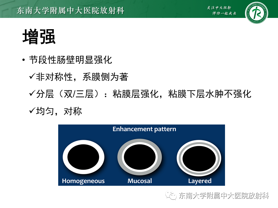 影像PPT - 【PPT】克罗恩(Crohn’s)病-23 影像PPT - 【PPT】克罗恩(Crohn’s)病-23