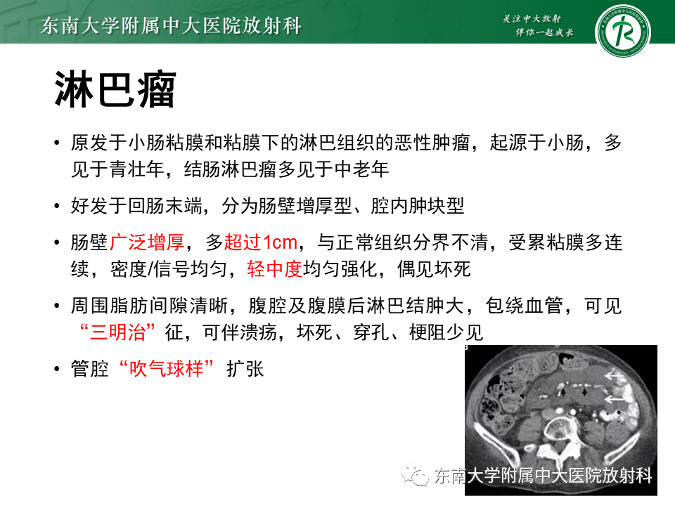影像PPT - 【PPT】克罗恩(Crohn’s)病-46 影像PPT - 【PPT】克罗恩(Crohn’s)病-46