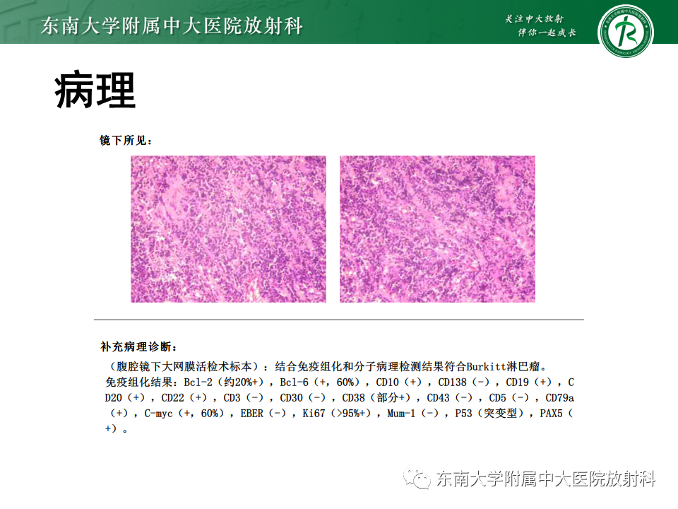 影像PPT - 【PPT】克罗恩(Crohn’s)病-48 影像PPT - 【PPT】克罗恩(Crohn’s)病-48