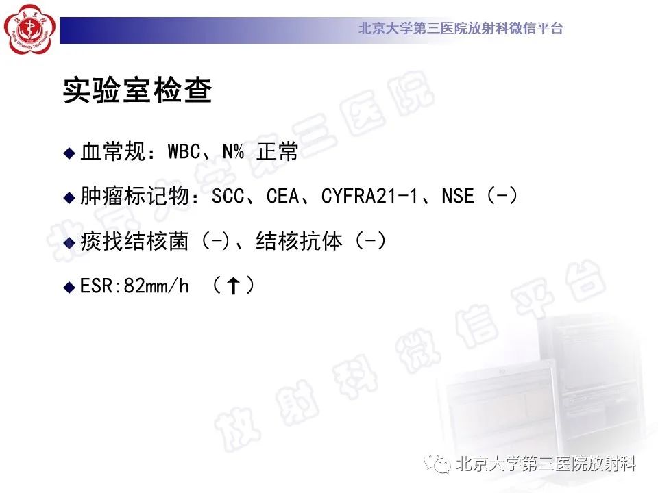 影像PPT - 【PPT】肺放线菌病-9