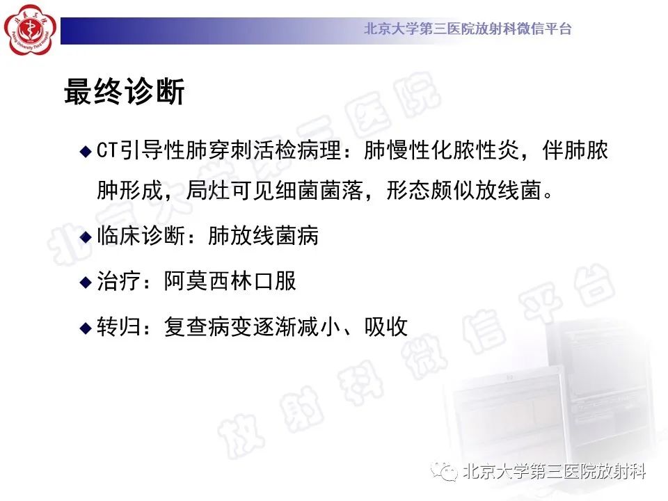 影像PPT - 【PPT】肺放线菌病-10