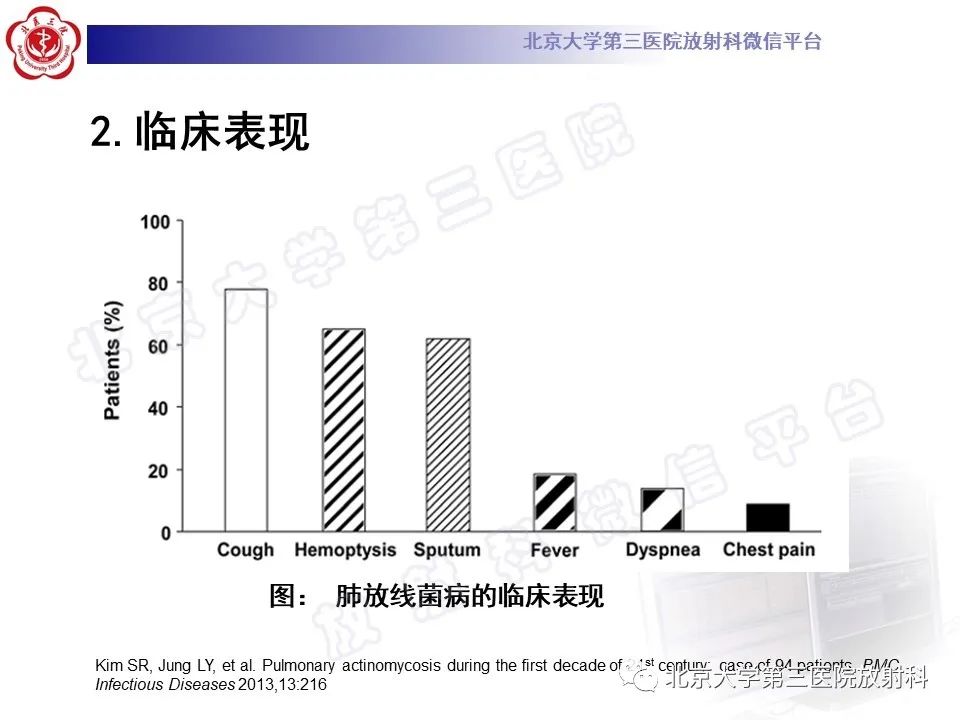 影像PPT - 【PPT】肺放线菌病-17