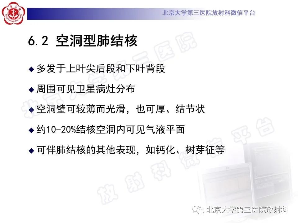 影像PPT - 【PPT】肺放线菌病-30