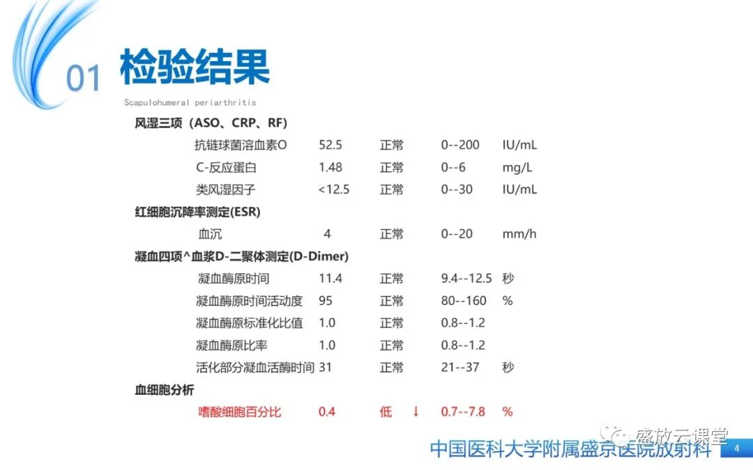 影像PPT - 【PPT】肩关节周围炎(肩周炎)-4
