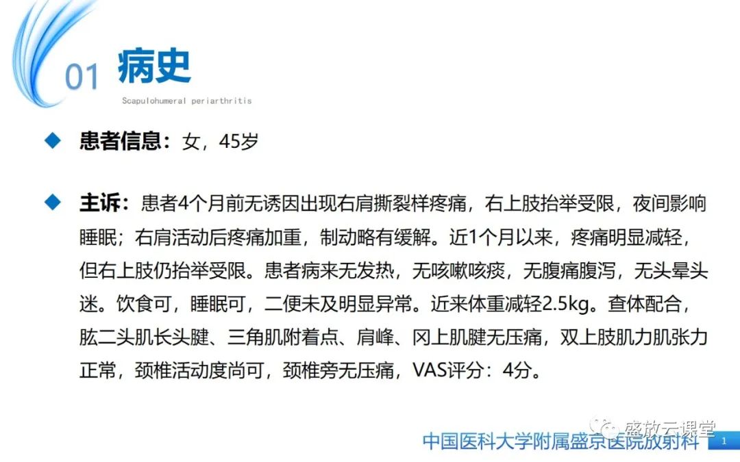 影像PPT - 【PPT】肩关节周围炎(肩周炎)-1