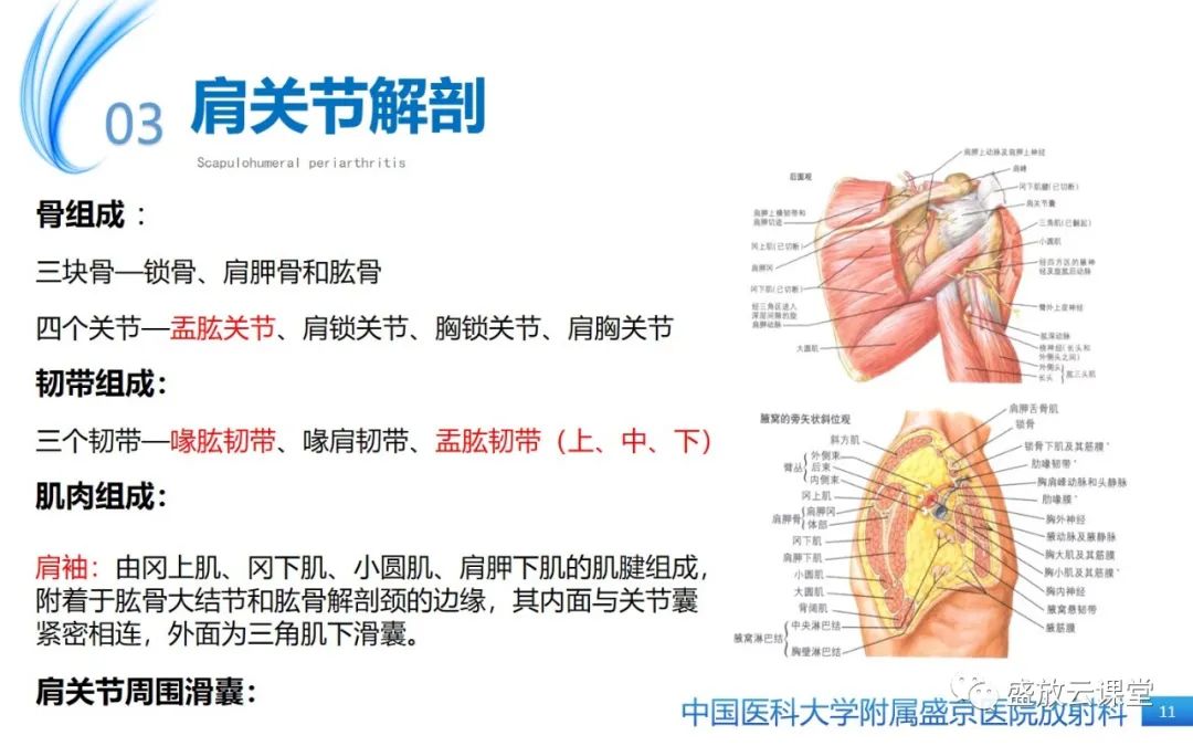 影像PPT - 【PPT】肩关节周围炎(肩周炎)-11